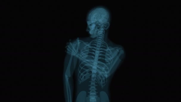 Dolor Hombro Xray Animación — Vídeo de stock