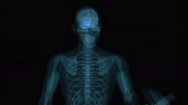 Röntgen çeken bir adamın 3 boyutlu animasyonu. 