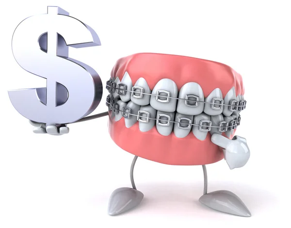 Cost of braces