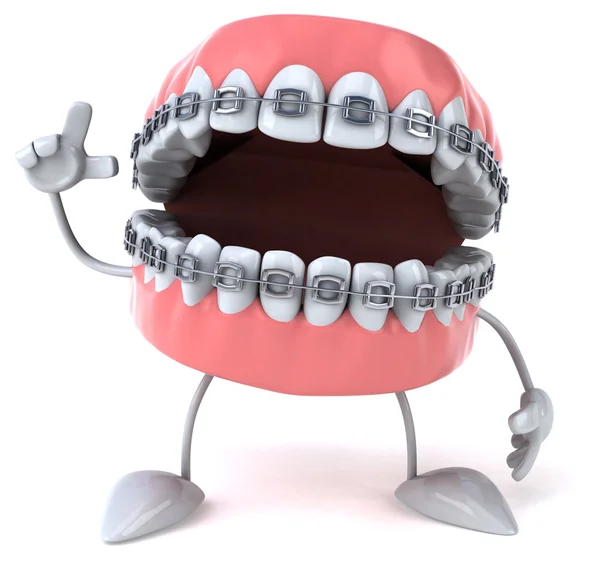 Fun teeth with braces — Stock Photo, Image