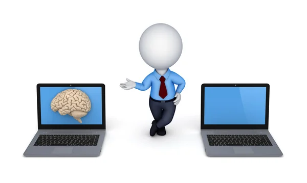 Cervello umano su uno schermo di computer portatile . — Foto Stock