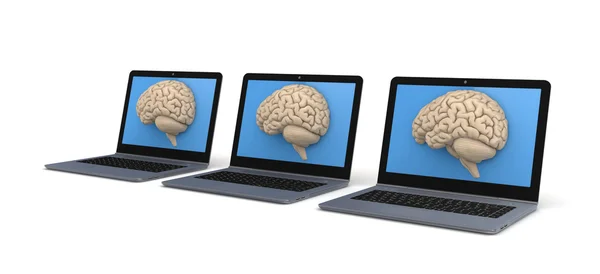 Human brain on a screen of laptop. — Stock Photo, Image