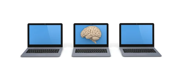 Human brain on a screen of laptop. — Stock Photo, Image