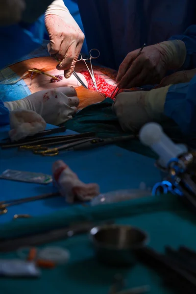 Surgery in a modern hospital being performed — Stock Photo, Image