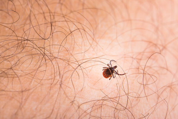 Tick - parasitic arachnid blood-sucking