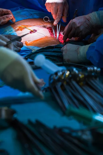 Surgery in a modern hospital — Stock Photo, Image