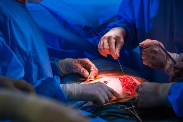 Team of surgeons performing an operation on a patient — Stock Photo, Image