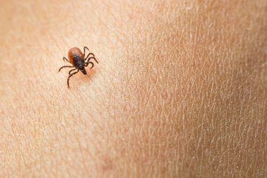 Tick - parasitic arachnid blood-sucking carrier of diseases clipart