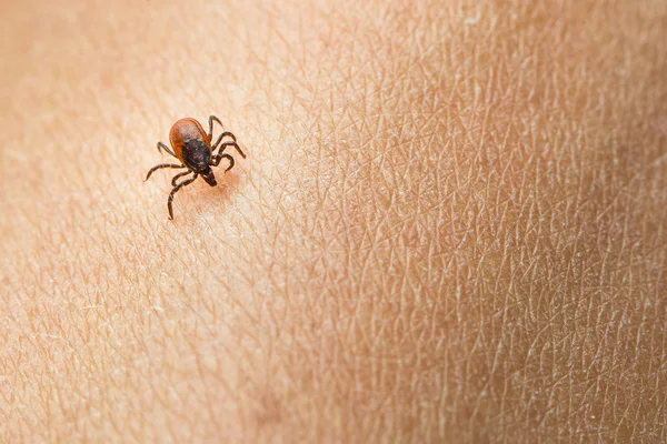 Kleszcz - przewoźnik krwiopijne pasożytnicze pajęczak chorób — Zdjęcie stockowe
