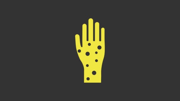 黄色灰色の背景に隔離された乾癬または湿疹のアイコンを持つ手。アレルゲンや慢性的な体の問題に対する人間の皮膚応答の概念.4Kビデオモーショングラフィックアニメーション — ストック動画