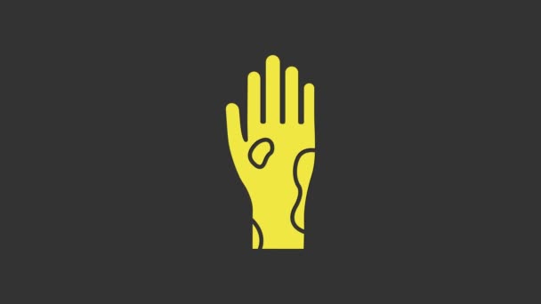 黄色灰色の背景に隔離された乾癬または湿疹のアイコンを持つ手。アレルゲンや慢性的な体の問題に対する人間の皮膚応答の概念.4Kビデオモーショングラフィックアニメーション — ストック動画