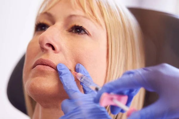 Close Mature Woman Seitting Chair Being Give Botox Injection Female — Stock fotografie