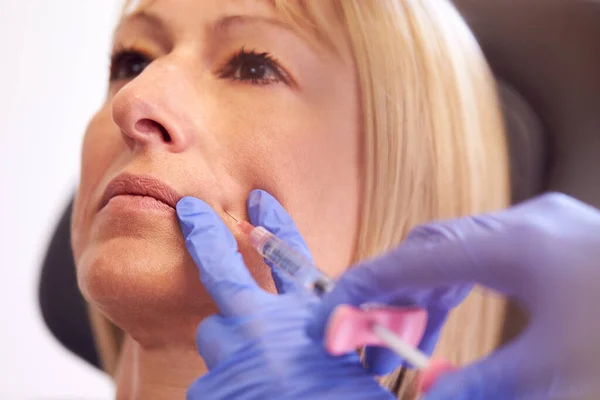 Närbild Mogen Kvinna Sitter Stolen Att Botox Injektion Kvinnliga Läkare — Stockfoto