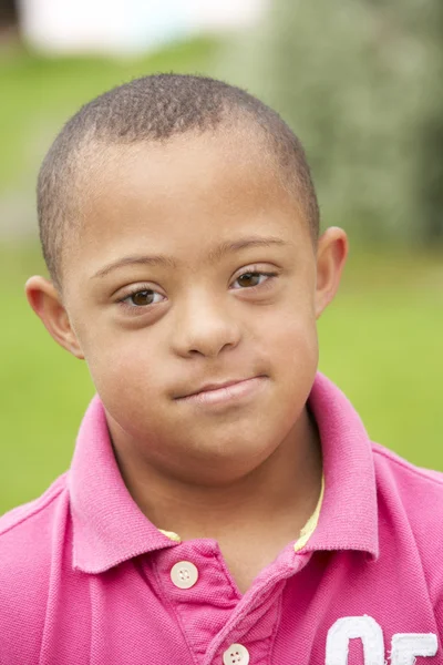 Niño con Síndrome de Downs —  Fotos de Stock