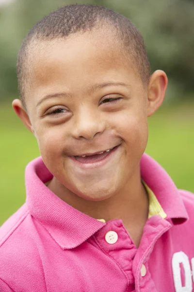 Мальчик с синдромом Дауна — стоковое фото