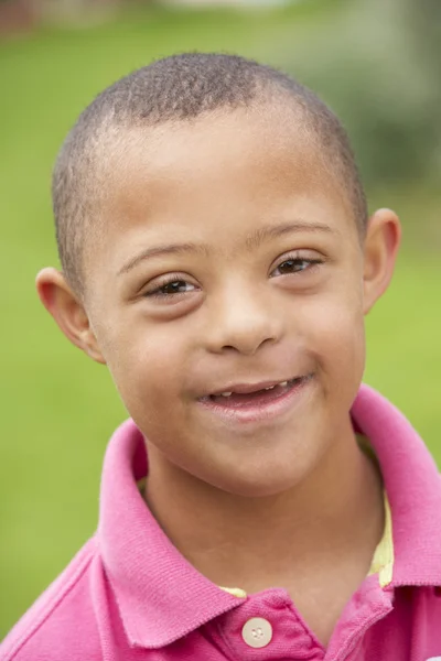 Niño con Síndrome de Downs — Foto de Stock