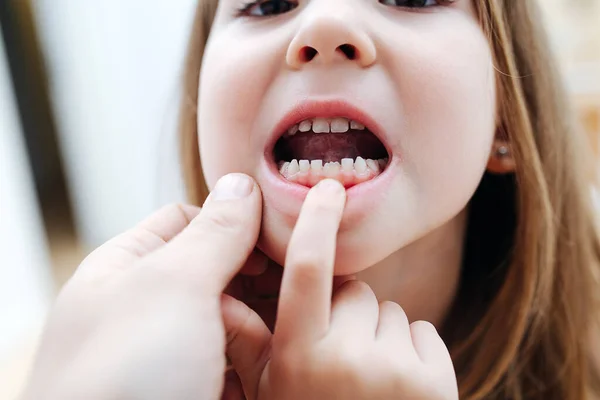 Daughter shows tooth growth to his father. — Stock Photo, Image
