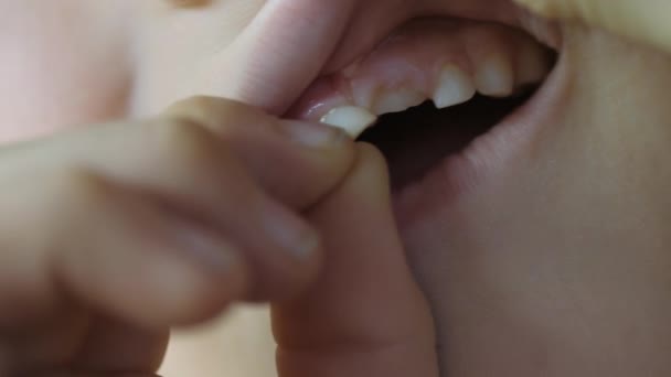 Cambio de dientes de bebé en un niño. — Vídeos de Stock