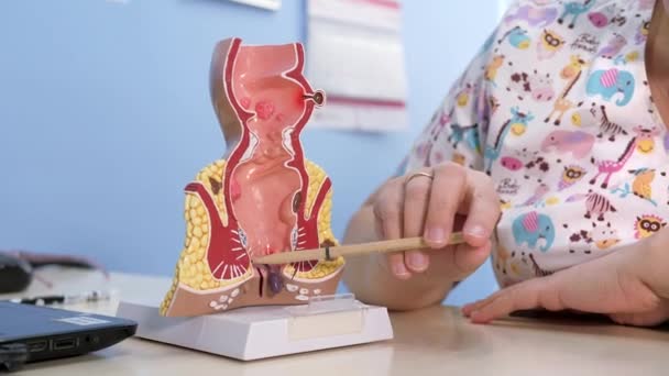 Proktolog poukazuje na patologii konečníku tužkou na anatomický model. — Stock video