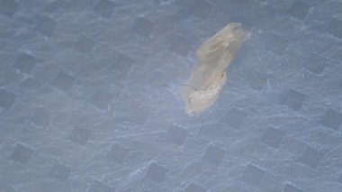 Morgelon. Tıbbi maskelerde Morgellon iplikleri. Maske solucanları. Kırmızı, mavi ve siyah parazitler sürünür. GNC