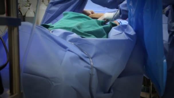 Chirurgie plastique une salle d'opération — Video