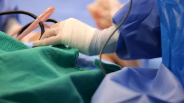 Cirurgia plástica uma sala de cirurgia — Vídeo de Stock