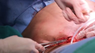 Plastik cerrahi ameliyathane bir