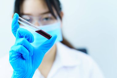 Laboratuvarda kan örneğini COVID, COVID-19, Coronavirus virüsü analizi için test tüpünde tutan teknisyen uzmanı.