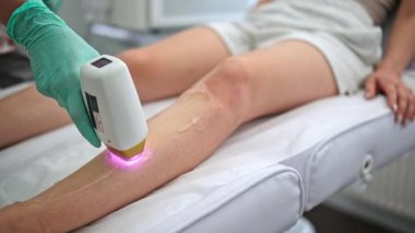 Spa Güzellik Kliniğinde Bacakları Lazer Vücut Tüy Çıkarma Prosedürü