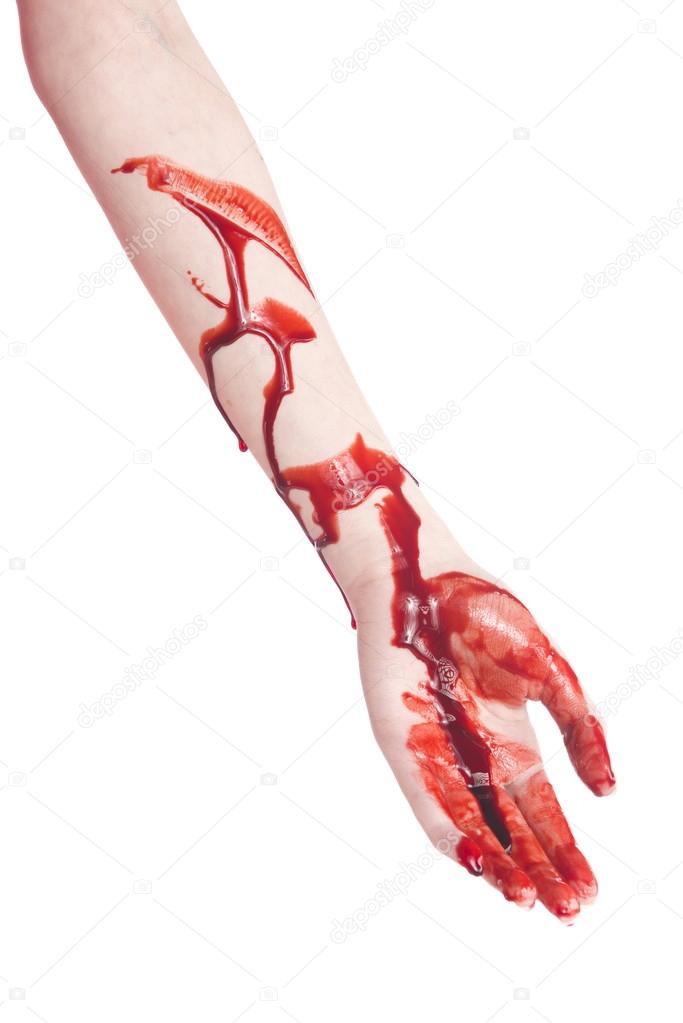 Close up Bloody Arm and Hand with Cuts