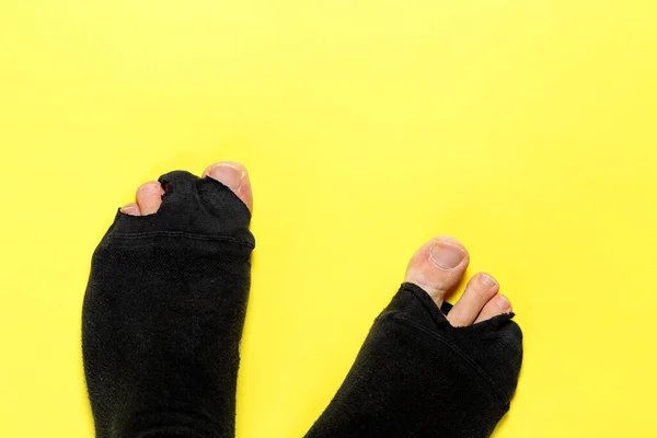 Обзор Изображения Ног Черных Носках Отверстиями Желтом — стоковое фото
