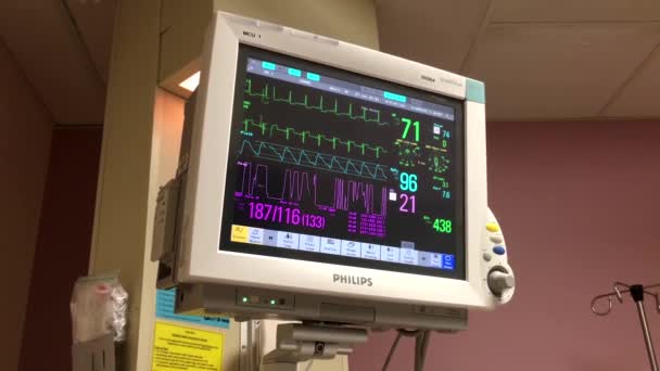 Contrôle des indications d'action du cœur et de la pression artérielle ecg, fréquence et amplitude des réductions — Video