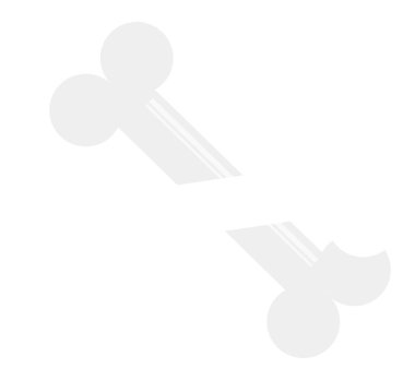 Kırık kemik, illüstrasyon, beyaz arka plandaki vektör..