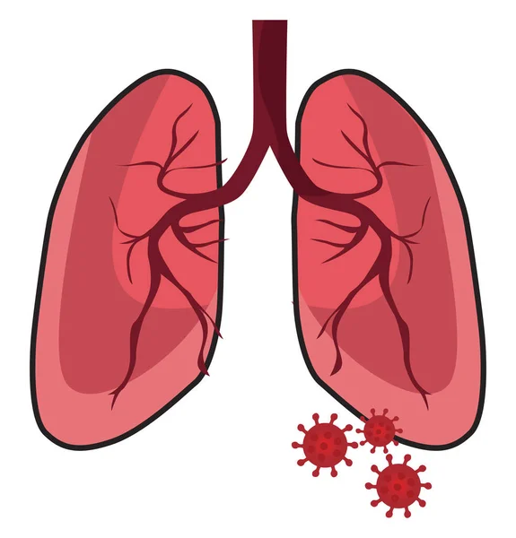 Pulmones Con Virus Ilustración Vector Sobre Fondo Blanco — Archivo Imágenes Vectoriales