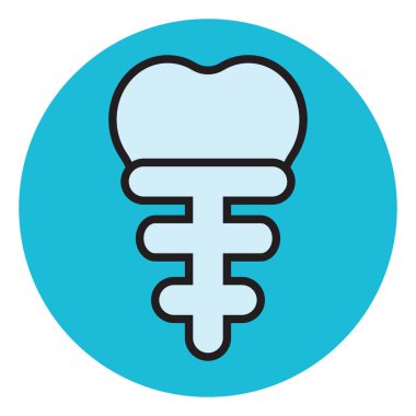 Beyaz arka planda diş implantı, illüstrasyon, vektör..