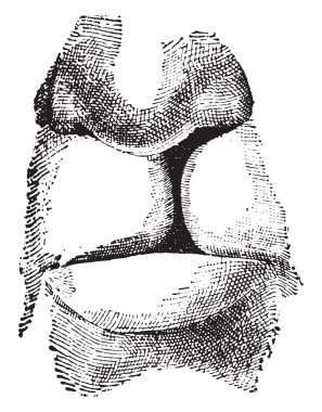 Tavşan dudak, vintage oyma.