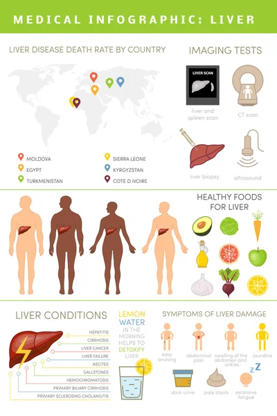 Conjunto de infográficos de fígado — Vetor de Stock