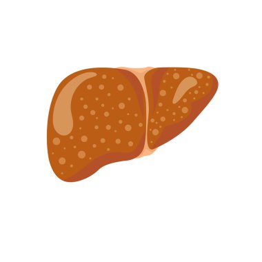 Aşama karaciğer hasarı DWW bitkisi