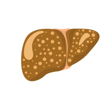 Karaciğer hasarı ayarlanıyor.