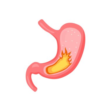 Mide bulantısı 2 dd ww