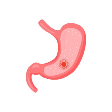 Mide bulantısı 2 dd ww