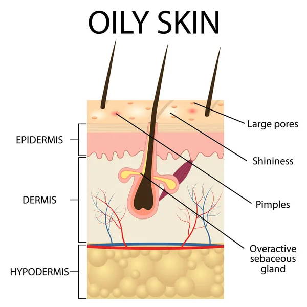 Illustration des couches de peau grasse — Image vectorielle