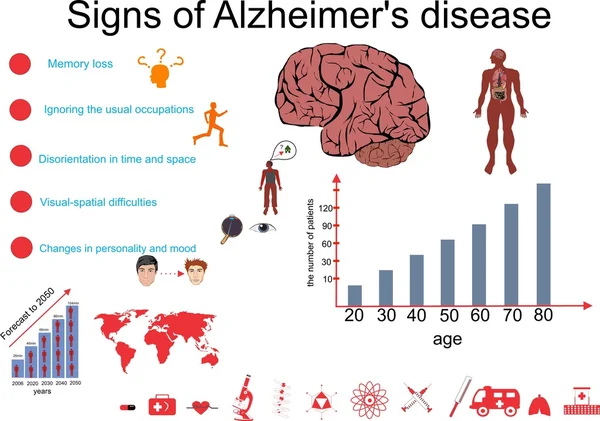 Alzheimer hastalığı Infographic vektör çizim
