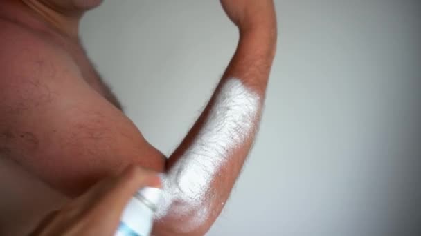 Hand toepassing speciale geneeskunde panthenol op de zon beschadigde gebruinde man hand huid — Stockvideo