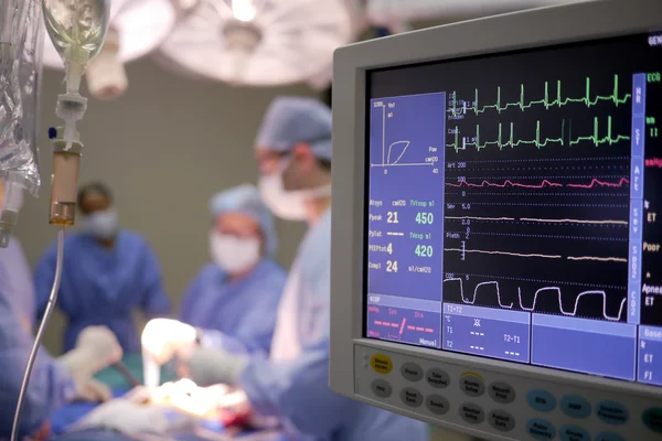 Sydänmonitori sairaalan leikkaussalissa — kuvapankkivalokuva