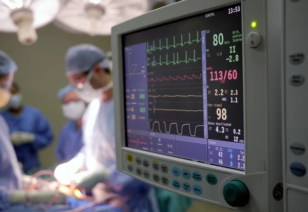 Monitor cardíaco em cirurgia hospitalar — Fotografia de Stock