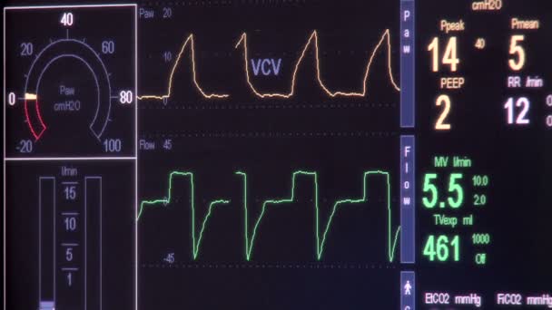 Perto de um batimento cardíaco em um monitor de coração — Vídeo de Stock