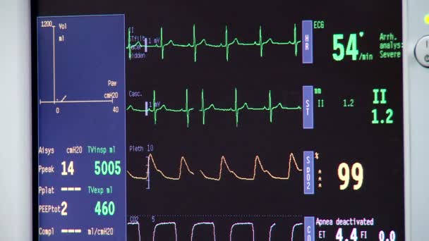 Primer plano de un latido del corazón en un monitor cardíaco — Vídeo de stock