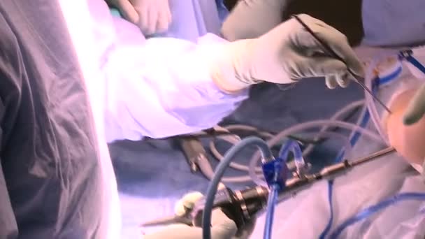 Équipe de médecins travaillant en chirurgie — Video