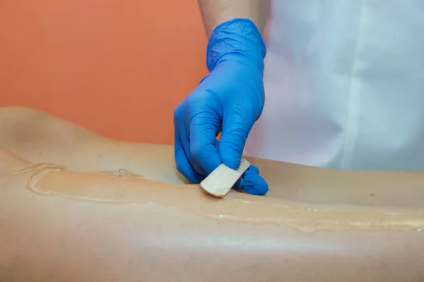 Laser hair removal procedure in a beauty salon. Removal of unwanted leg hair. The master applies the gel. — Stock Photo, Image